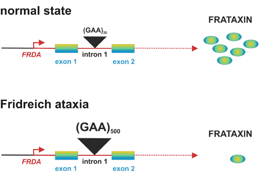 Friedrich ataxia